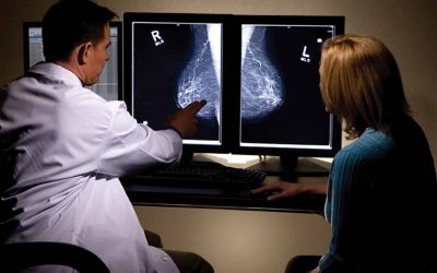 £1 million initiative to help reduce breast cancer risk in over-50s